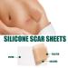 Scar Removal Tape 59.1in Roll | Reduce Hyperplasia & Improve Metabolism for Scars - Buy Online on GoSupps.com