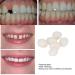 2pcs 50g False Teeth Solid Glue Kit - Temporary Tooth Replacement & Repair Adhesive - Buy Online on GoSupps.com