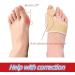 Bunion Corrector for Men and Women - Pain Relief Hallux Valgus Corrector Socks with Splint Pads and Cushion Guards - Orthopedic Support Brace and Toe Spacer for Hammer Toe Relief - Buy Online on GoSupps.com