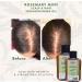 ican London Rosemary Mint Scalp & Hair Treatment Oil For Faster Hair Growth 50ml - Buy Online on GoSupps.com