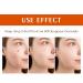 Salicylic Acid Acne Treatment Cream for Face & Body - Teens & Adults | Anti-Acne Moisturizer & Spot Treatment - Buy Online on GoSupps.com