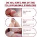 Dajidafu Nails Repairing Extension Gel Portable Fingernail Manicure Pedicure Polish Accessory for Household Professional Salons - Buy Online on GoSupps.com