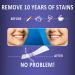 MySmile 28 Peroxide-Free Whitening Strips | Enamel Safe & Non-Sensitive | Dentist Formulated for Deep Stain Removal | Fast Results | 14 Sessions - Buy Online on GoSupps.com