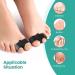 Welnove 8 Pack Bunion Corrector & Toe Spacer with Gel - Big Toe Separators for Overlapping Toes - Reduce Pain and Discomfort - Black - Buy Online on GoSupps.com