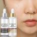 Lumeva Peel Shot 2pcs Lumeva Visage Point Noir Peel Shot Glow Ampoule Exfoliante Peels Shot Exfoliant Visage Cor En S Rum Exfoliant Riz Noir & Blanc Nettoyage En Profondeur Des Pores