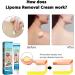 Lipoma Removal Cream Cr me d' limination de lipomes Cellulite Removal Exfoliating Cream Get Rid of Your Fatty Lipoma Lumps (2pcs) - Buy Online on GoSupps.com