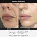 Medicube Age-R USSERA - Advanced Anti-Aging Device - Buy Online on GoSupps.com