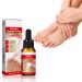 30ml Ingrown Toenail Treatment Drop Natural Ingrown Toenail Correction Oil Cuticle Care Oils for Toe Fungal Nail Treatment Trimming Nail Softening Drop Extra Strong for Damaged Nails