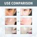 lmoikesz Women Face Anti-wrinkle Serum Ladies Moisturizing Hydrating Firming Tightening Wrinkle Removal Essence - Buy Online on GoSupps.com