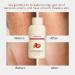 2Pcs strawberry Skin Treatment trawberry Legs Treatment Advanced Triple-Acid Complex Trystrawberry Resurfacing Cream Helps Reduce Chicken Skin Bumps Exfoliating Body Cream With Deep Hydration - Buy Online on GoSupps.com