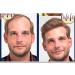 Fast Hair Growth Serum | Prevent Hair Loss & Thinning | Targets Alopecia & Hairline Issues | Postpartum & Seasonal Care Oil - Buy Online on GoSupps.com