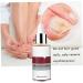 1PC Nail Repairs Nail Treatment Nail Renewal Solution Toenails & Fingernails Nail Repairs Essential Oil Protects From Discoloration Brittle And Cracked Nail(12ML) - Buy Online on GoSupps.com