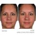 Serious Skincare A Defiance 4 Million IU Retinol A Cream XR for Face & Neck | Anti-Aging Moisturizer with Retinol & Green Tea Extract | Reduce Fine Lines - Buy Online on GoSupps.com
