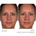 Serious Skincare A Force XR Retinol Serum 1oz - Anti-Aging & Anti-Wrinkle Treatment with Time Released Vitamin A & Green Tea Extract - Buy Online on GoSupps.com