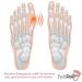 Bunion Corrector & Toe Straightener for Bunion Relief | Restores Natural Toe Alignment, Spacer & Stretcher Included - Buy Online on GoSupps.com