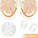 Silicone Anti-Friction Toe Protectors | Gel Toe Sleeves for Corns & Blisters | Pain Relief - 30PCS for Men & Women - Buy Online on GoSupps.com