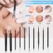 Fangze Pimple Popper Tool Kit - 10pcs Stainless Steel Blackhead Remover Set with Leather Bag - Buy Online on GoSupps.com