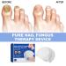 Furzero Nail Fungus Laser Treatment Device | Effective Laser Therapy for Nail Fungus - Buy Online on GoSupps.com