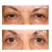 SUPPORT PLUS Eyelid Lifting Cream | Hyaluronic Acid & Caffeine Eye Cream for Youthful Eyes - 1 Oz | International Shipping Available - Buy Online on GoSupps.com