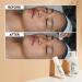 DM.Cell Gentle Aqua Facial Gommage Cleanser - Peeling Scrub Gel with Natural Extracts for Blackheads & Enlarged Pores | Paraben Free | Korean Skin Care | 3.38 fl oz - Buy Online on GoSupps.com