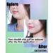 V Shaped Slimming Face Mask | Hydrogel Double Chin Reducer & Neck Lift | Firming & Tightening Skin Patch - Buy Online on GoSupps.com