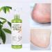 Foot Peeling Spray Orange Oil Foot Peeling Spray That Remove Dead Skin Tea Tree Foot Peeling Spray Remove Dead Skin within Seconds Exfoliator For Cracked Rough Heels Dry Toe Skin&Calluses (Green) - Buy Online on GoSupps.com