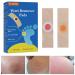 Wart Remover Corn Remover Foot Corn Remover Pads Plantar Wart Removal Corn Callus Remover Penetrates and Removes Common and Plantar Warts Callus Stops Wart Regrowth 20PC