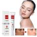 Q.Z.Art Dark Spot Corrector Cream | Remover for Face | Melasma Freckle & Sun Spot Treatment | Suitable for All Skin Types - Buy Online on GoSupps.com