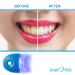 EverWhite Teeth Whitening Accelerator Light - 5x Powerful Blue LED for Faster Results - Buy Online on GoSupps.com