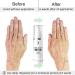 Eylleaf Anti-Pigmentation Hand Cream - Age Spot Remover for Mature Skin or Discoloration Symptoms 30ml - Buy Online on GoSupps.com