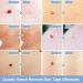 Remove Skin Tag Pen Facial Care Nevus Tool 2mm-4mm Remove Meat Nevus Corns Warts Skin Tag Removal Tool GLFA - Buy Online on GoSupps.com