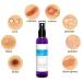 Topical Probiotic Spray for Skin - 13 Live Strains | Skin Care for Acne, Folliculitis, Dermatitis, Rosacea, Eczema | Body & Face Mist Deodorant - Buy Online on GoSupps.com