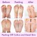 Foot Peel Mask 4 Pairs Natural Lavender Foot Peel Mask For Hard Skin-Foot Mask Hard Skin Remover Foot-Plantifique Foot Peel Mask-Baby Foot Foot Care(Lavender) - Buy Online on GoSupps.com