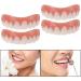 Buy Generic Smiling Braces for Upper False Teeth Veneers - 4 PCS | Cosmetic Tooth Covers for Perfect Smile - International Shipping - Buy Online on GoSupps.com