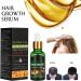 Dermaroller Set de micro-aiguilles professionnelles en titane avec 1 jeu de s rum de croissance des cheveux anti-chute de cheveux 1 jeu d'aiguilles professionnelles en titane de 0 5 mm 30 ml (Lot de 1) - Buy Online on GoSupps.com