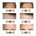 10 Anti-Aging Forehead Wrinkle Patches | Facial Anti-Fold Moisturizing Treatment - Shop Internationally - Buy Online on GoSupps.com