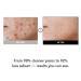 KIOSKIN 98% Reduction in Pore Impurities & 92% Less Sebum Improves Blackheads & Whiteheads by 36% Soothes & Strengthens Skin Barrier with D-Panthenol Korean Skincare Best Cleansing Foam - Buy Online on GoSupps.com
