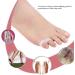 Toe Spreader & Cushion Set - 10 Soft Gel Pieces for Pain Relief & Toe Correction - Buy Online on GoSupps.com