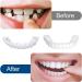 Uqlpxz 2 Pairs False Teeth Set - Temporary Cosmetic Veneers for Men & Women | Whitening Solution for Imperfect Teeth - Buy Online on GoSupps.com