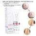 Stretch Mark Cream - Effective Pregnancy & Scar Treatment | Elimina Estr as - Buy Online on GoSupps.com