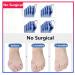 Orthopedic Big Toe Valgus Corrector for Pain Relief - Non-Surgical Bunion & Hammer Toe Straightener - Buy Online on GoSupps.com