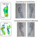 Inook Talflat Correction Socks for Foot Pain Relief - Flat Feet Fallen Arches & Hallux Valgus - kotex Certified Black - Buy Online on GoSupps.com