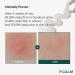 P.CALM Centella Trouble Spot Cream 0.5 fl. oz | Vegan Breakout Relief for Sensitive Skin | Korean Skincare - Buy Online on GoSupps.com