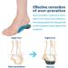 3/4 Orthotic Insoles for Plantar Fasciitis Relief | High Arch Support Inserts for Flat Feet & Heel Pain | Medium Size Men 6.5-8.5 / Women 7.5-9.5 - Shop Now - Buy Online on GoSupps.com