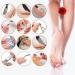 Rechargeable Electric Callus Remover for Feet with Vacuum - Professional Pedicure Tool Kit for Deadskin Removal - 3 Heads, 2 Speeds, LCD Display - Buy Online on GoSupps.com