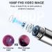 Premium Ear Wax Removal Tool Camera - 1080P Otoscope with Light for iPhone iPad & Android - Ear Cleaning Kit - Buy Online on GoSupps.com