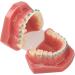 Typodont Orthodontic Tooth Model (28 Teeth) - Realistic Crowded Teeth & Malocclusion Representation for Dental Education & Practice - Buy Online on GoSupps.com