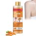 Soft 7 Turmeric Oil, Veetgold Body Oil, Veetgold Turmeric Oil, Veetgold Turmeric Body Oil, Soft 7 Body Oils, Turmeric Body Oil for Face & Body Moisturizer (., Carrot 100 ml)