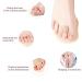 Buy 2 Pieces Toe Straightener & Hammer Toe Splint for Men & Women - Bunion Curve & Overlapping Hammer Relief - Buy Online on GoSupps.com