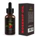 Besstoil Rosehip Seed Oil 100% Pure Natural Cold Pressed Unrefined Non-GMO Carrier Oil - Anti-Aging Moisturizer for Face, Skin, Hair & Nails - 3.52 oz - Buy Online on GoSupps.com